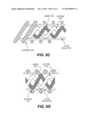 CARDIAC RHYTHM MANAGEMENT SYSTEM WITH INTRAMURAL MYOCARDIAL PACING LEADS AND ELECTRODES diagram and image