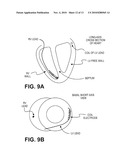 CARDIAC RHYTHM MANAGEMENT SYSTEM WITH INTRAMURAL MYOCARDIAL PACING LEADS AND ELECTRODES diagram and image