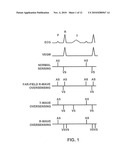 METHOD AND APPARATUS FOR IDENTIFYING CARDIAC AND NON-CARDIAC OVERSENSING USING INTRACARDIAC ELECTROGRAMS diagram and image