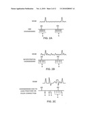 METHOD AND APPARATUS FOR IDENTIFYING CARDIAC AND NON-CARDIAC OVERSENSING USING INTRACARDIAC ELECTROGRAMS diagram and image