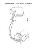 METHOD AND APPARATUS FOR IDENTIFYING CARDIAC AND NON-CARDIAC OVERSENSING USING INTRACARDIAC ELECTROGRAMS diagram and image