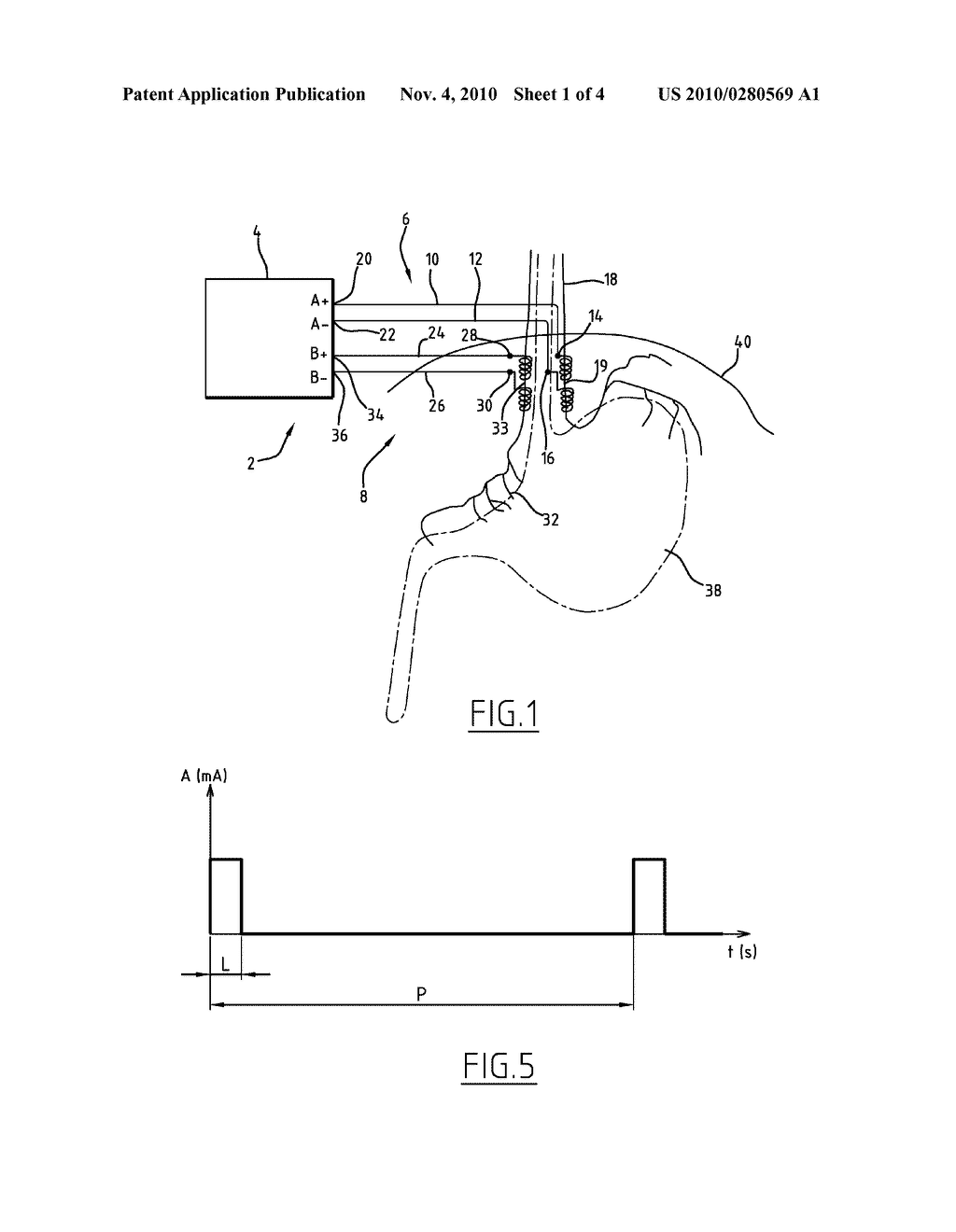 DEVICE AND METHOD FOR REDUCING WEIGHT - diagram, schematic, and image 02