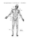 ACTIVE IMPLANTABLE MEDICAL SYSTEM HAVING EMI SHIELDED LEAD diagram and image