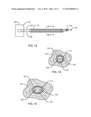 ACTIVE IMPLANTABLE MEDICAL SYSTEM HAVING EMI SHIELDED LEAD diagram and image