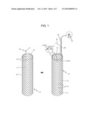 DRAWSTRING FOR REMOVAL OF STENT diagram and image