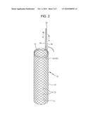 DRAWSTRING FOR REMOVAL OF STENT diagram and image