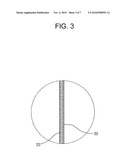 DRAWSTRING FOR REMOVAL OF STENT diagram and image