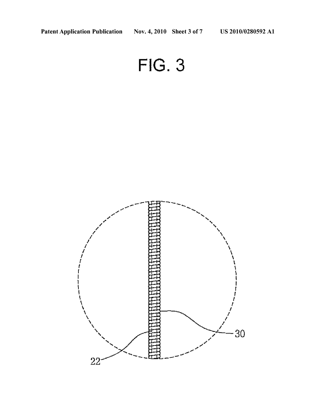 DRAWSTRING FOR REMOVAL OF STENT - diagram, schematic, and image 04