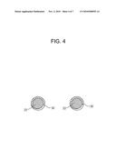 DRAWSTRING FOR REMOVAL OF STENT diagram and image