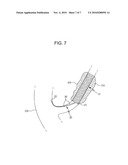 DRAWSTRING FOR REMOVAL OF STENT diagram and image