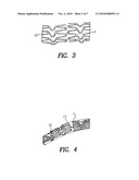 STENT WITH VARIABLE FEATURES TO OPTIMIZE SUPPORT AND METHOD OF MAKING SUCH STENT diagram and image