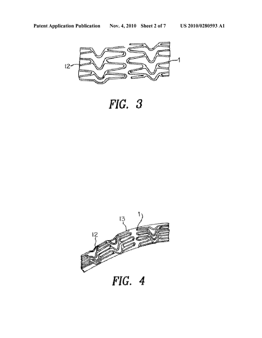 STENT WITH VARIABLE FEATURES TO OPTIMIZE SUPPORT AND METHOD OF MAKING SUCH STENT - diagram, schematic, and image 03