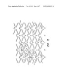 STENT WITH VARIABLE FEATURES TO OPTIMIZE SUPPORT AND METHOD OF MAKING SUCH STENT diagram and image