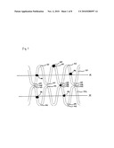 Tubular Supporting Prosthesis Having a Heart Valve, Particularly for Aortic Valve Replacement diagram and image