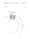 Tubular Supporting Prosthesis Having a Heart Valve, Particularly for Aortic Valve Replacement diagram and image