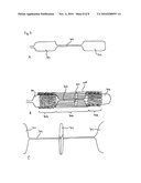 Tubular Supporting Prosthesis Having a Heart Valve, Particularly for Aortic Valve Replacement diagram and image