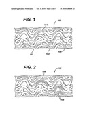 DUAL DRUG STENT diagram and image