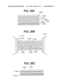 DUAL DRUG STENT diagram and image