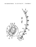 DEPLOYMENT TECHNIQUES FOR ANNULOPLASTY RING diagram and image