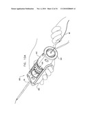 DEPLOYMENT TECHNIQUES FOR ANNULOPLASTY RING diagram and image