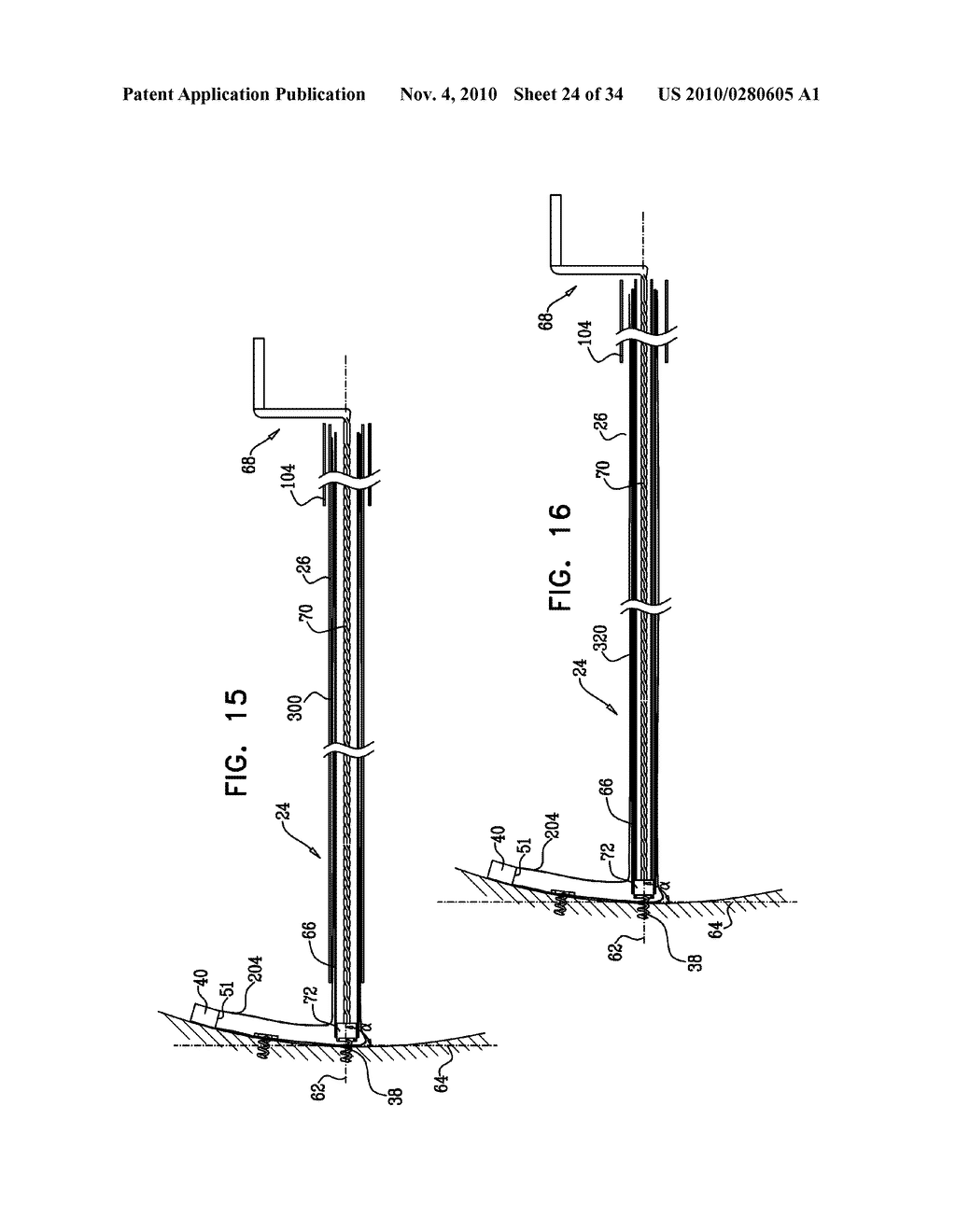 DEPLOYMENT TECHNIQUES FOR ANNULOPLASTY RING - diagram, schematic, and image 25