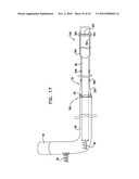 DEPLOYMENT TECHNIQUES FOR ANNULOPLASTY RING diagram and image