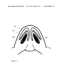 NASAL IMPLANT INTRODUCED THROUGH AN INJECTION TECHNIQUE diagram and image