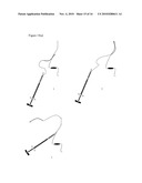 NASAL IMPLANT INTRODUCED THROUGH AN INJECTION TECHNIQUE diagram and image