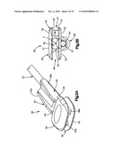 TRIAL IMPLANT ASSEMBLY diagram and image