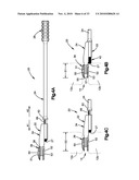 TRIAL IMPLANT ASSEMBLY diagram and image