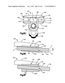 TRIAL IMPLANT ASSEMBLY diagram and image