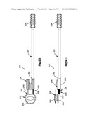 TRIAL IMPLANT ASSEMBLY diagram and image