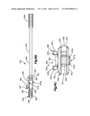 TRIAL IMPLANT ASSEMBLY diagram and image