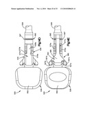 TRIAL IMPLANT ASSEMBLY diagram and image