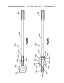 TRIAL IMPLANT ASSEMBLY diagram and image