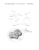 System and method for modifying talocalcaneal relationship in a foot diagram and image