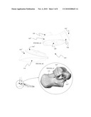 System and method for modifying talocalcaneal relationship in a foot diagram and image