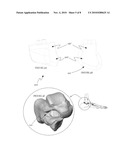 System and method for modifying talocalcaneal relationship in a foot diagram and image