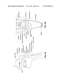 DEVICES AND METHODS FOR TREATING SLEEP DISORDERED BREATHING diagram and image