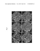 CYTOCHROME P450 GENE FOR INCREASING SEED SIZE OR WATER STRESS RESISTANCE OF PLANT diagram and image