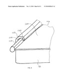 PATIENT POSITIONING DEVICE diagram and image