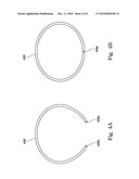 EXTERNALLY REPLACEABLE VACUUM CHAMBER TO CHAMBER FLANGE SEAL diagram and image