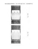 METHOD AND SYSTEM FOR TOMOGRAPHIC RECONSTRUCTION IN MEDICAL IMAGING USING THE CIRCLE AND LINE TRAJECTORY diagram and image