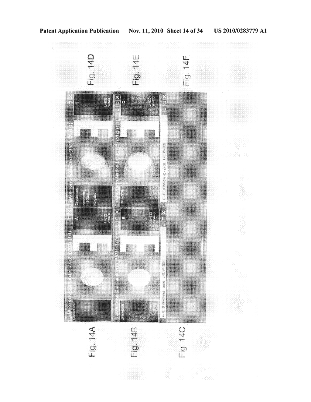 METHOD AND SYSTEM FOR TOMOGRAPHIC RECONSTRUCTION IN MEDICAL IMAGING USING THE CIRCLE AND LINE TRAJECTORY - diagram, schematic, and image 15