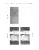 METHOD AND SYSTEM FOR TOMOGRAPHIC RECONSTRUCTION IN MEDICAL IMAGING USING THE CIRCLE AND LINE TRAJECTORY diagram and image