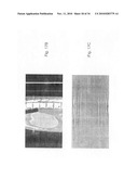 METHOD AND SYSTEM FOR TOMOGRAPHIC RECONSTRUCTION IN MEDICAL IMAGING USING THE CIRCLE AND LINE TRAJECTORY diagram and image