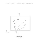 SEGMENTATION OF MICROCALCIFICATIONS IN A MAMMOGRAPHIC IMAGE diagram and image