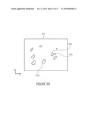 SEGMENTATION OF MICROCALCIFICATIONS IN A MAMMOGRAPHIC IMAGE diagram and image