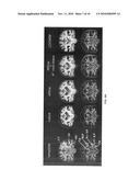 AUTOMATED IMAGE ANALYSIS FOR MAGNETIC RESONANCE IMAGING diagram and image
