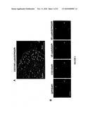 TREATMENT OF TUMORS BY ABLATING BONE MARROW-DERIVED ENDOTHELIAL PROGENITOR CELLS diagram and image